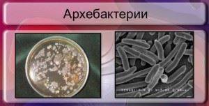 Какие есть формы бактериальной клетки и зачем микроорганизмам такое разнообразие?