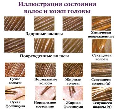 Диагностика заболеваний и лечение волос