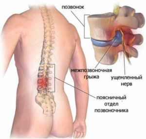 Долобене: состав, аналоги, отзывы, побочные эффекты