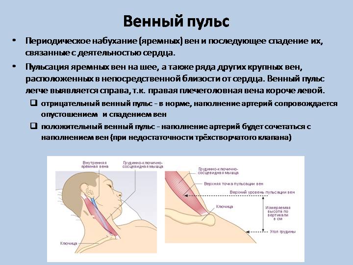 Как называется линия сердцебиения