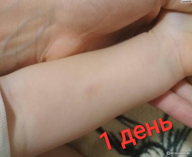 Диаскинтест