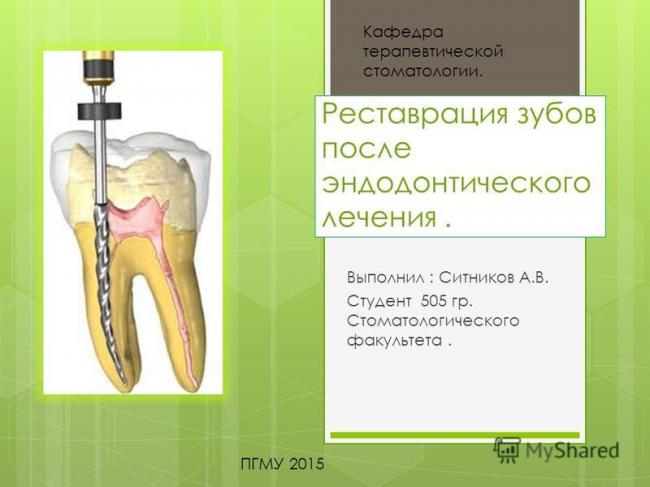 Штифты для восстановления сильно поврежденных зубов
