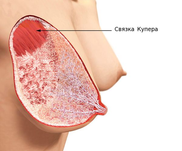 Птоз груди