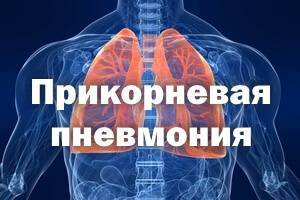 Прикорневая пневмония у детей