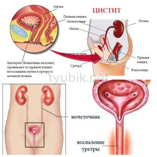 Индометацин Софарма