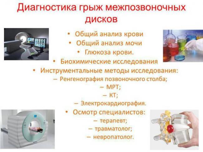 Экструзия дисков позвоночника: причины, симптомы и лечение