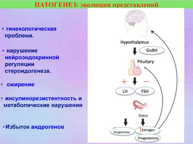 Симптомы и причины поликистоза яичников