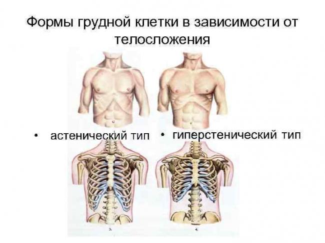 Деформация грудной клетки: степени, причины, лечение. воронкообразная и килевидная деформация грудной клетки