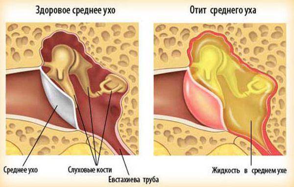 Почему чешутся уши и что с этим делать