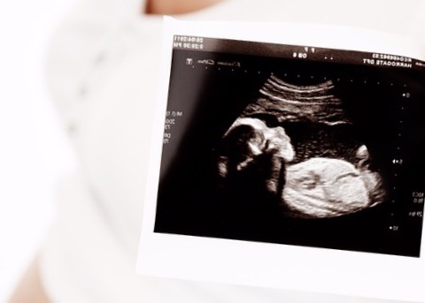 Кислородное голодание плода: причины, симптомы, последствия / mama66.ru