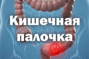 Бактерии группы кишечной палочки: виды и особенности возбудителя