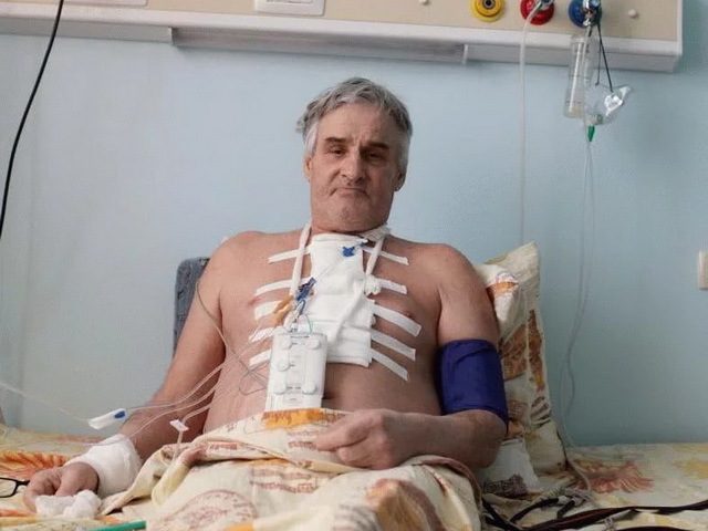 Стентирование сосудов сердца: жизнь после операции, реабилитация, питание и диета