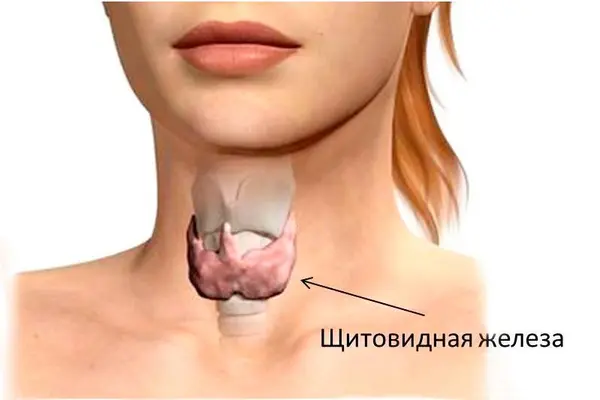 Эндемический зоб — симптомы, лечение и профилактика