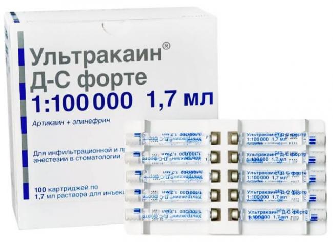 Ультракаин — в стоматологии, при беременности, грудном вскармливании