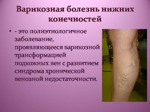 Купероз на лице: причины и лечение, удаление сосудистых звездочек лазером на лице и ногах