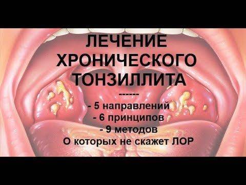 Как повысить иммунитет взрослому человеку в домашних условиях при ангине?