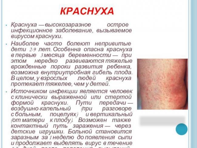 Ветрянка и краснуха у детей: переносятся легко. симптомы, лечение и уход за больным ребенком. ветряная оспа и краснуха у детей: признаки и лечение