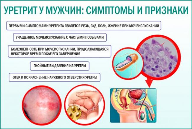 Ровамицин купить, цена на ровамицин 945 руб в москве, инструкция по применению, отзывы, аналоги