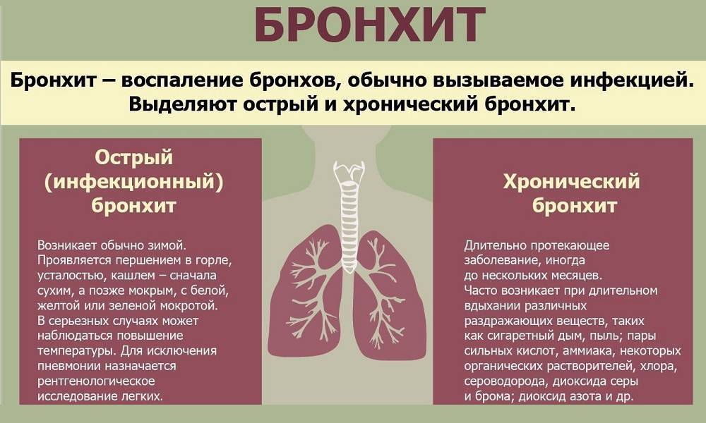 Как лечить бронхит у взрослых
