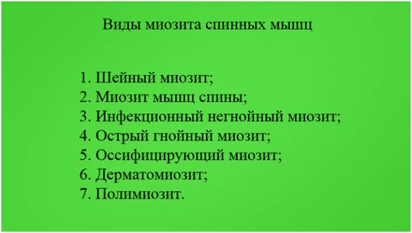 Миозит грудного отдела позвоночника по мкб 10
