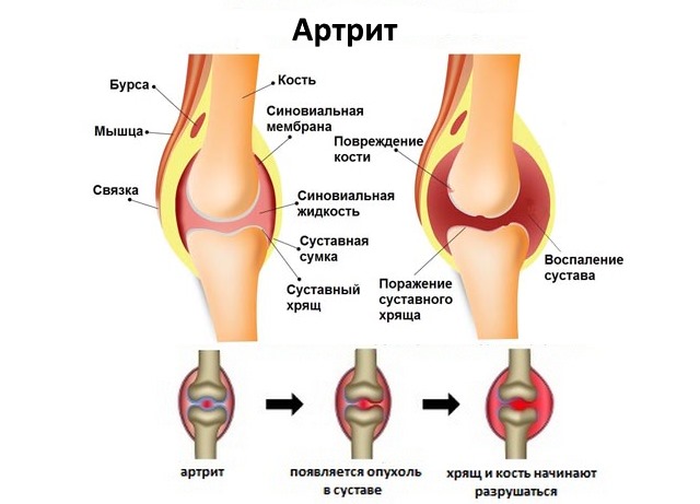 Фламидез : инструкция по применению