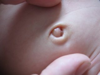 Мокнущий пупок у детей и взрослых: причины, симптомы, способы лечения