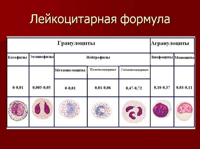 Эозинофилия - причины, формы, симптомы, диагностика и лечение
