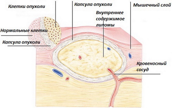 Почему возникают красные уплотнения на коже