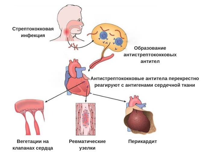 Диагностика и профилактика туберкулеза