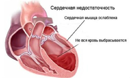 Препарат: юперио в аптеках москвы