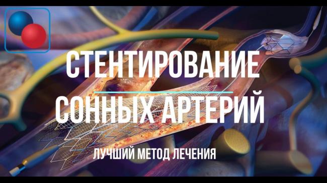 Причины, симптомы и профилактика окклюзи артерий ног