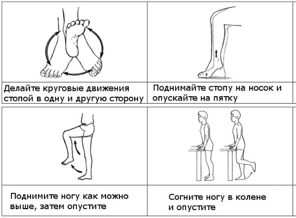 Лимфостаз — что это такое? симптомы и лечение по локализации, стадии