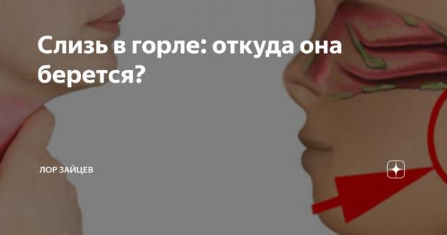 Белая cлизь в горле: причины и лечение. как избавиться?