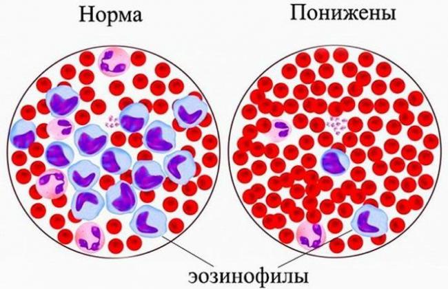 Эозинофилы повышены у взрослого — о чем это говорит, норма в крови, причины повышения