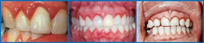 Зубные капли Dental drops инструкция по применению