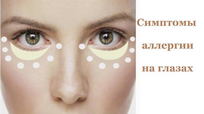 Аллергия на глазах