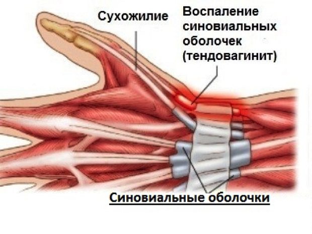 Индовазин мазь. инструкция по применению, цена, аналоги, отзывы