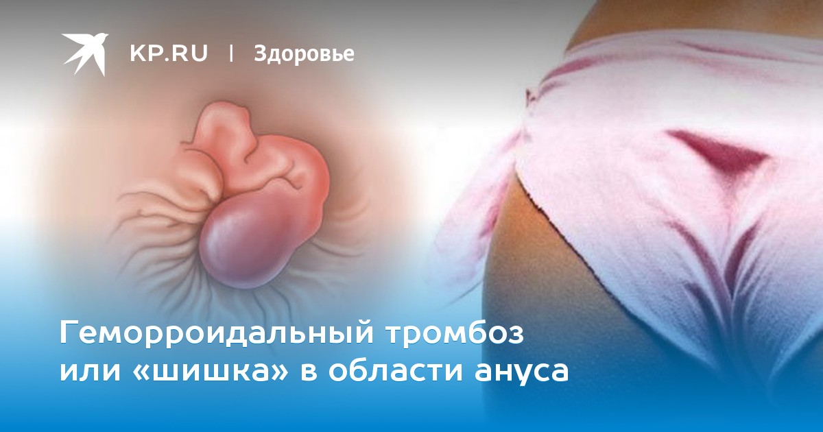 Деликатная проблема: эффективное и безопасное лечение зуда заднего прохода