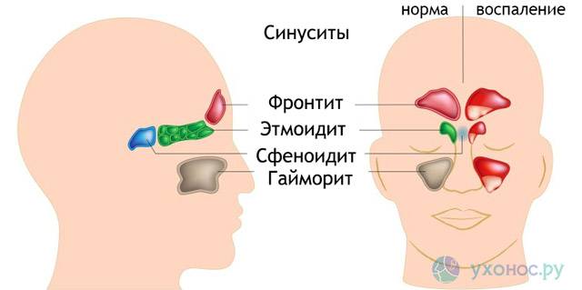Мкб 10 врожденная перфорация носовой перегородки