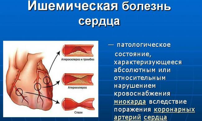 Тразикор