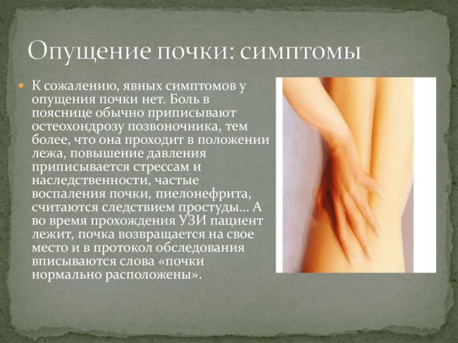 Что такое нефроптоз и как вернуть почку на место