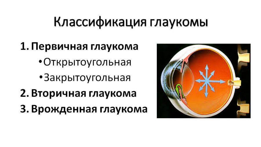 Глаукома: симптомы и лечение, что это такое - открытоугольная и закрытоугольная, признаки и острый приступ, профилактика, лечение