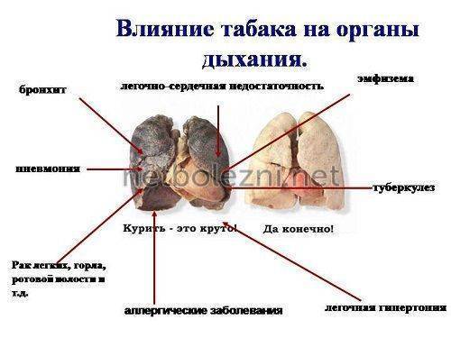 Самый эффективный препарат от бронхита