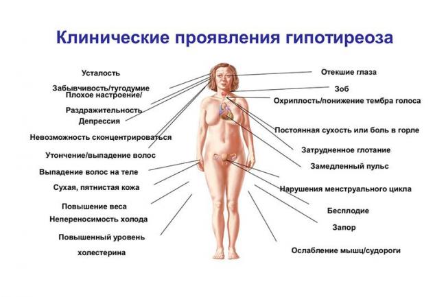 Зоб щитовидной железы. причины, симптомы, диагностика и лечение зоба