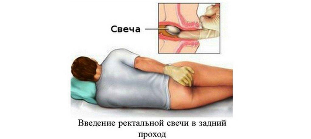 Диклоберл таблетки инструкция по применению цена