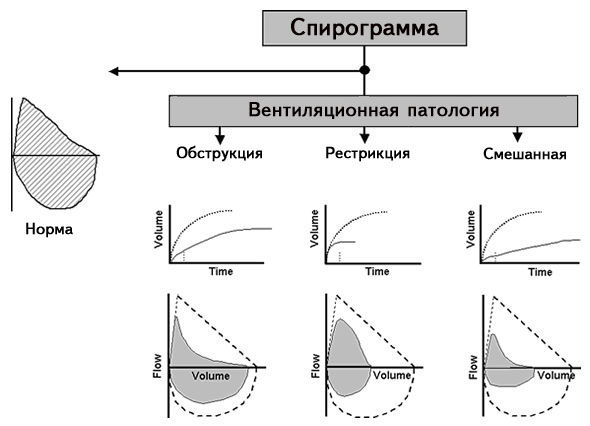 Спирография – что это за процедура, как проводится фвд (функция внешнего дыхания)