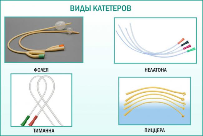 Как проводится катетеризация у женщин?