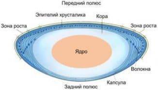 Кто вылечил катаракту народными средствами