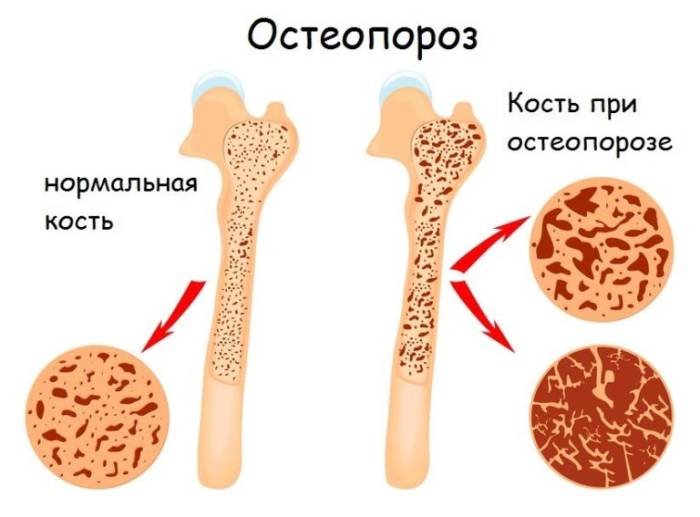 Артра: инструкция по применению