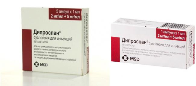 Для чего назначают уколы дипроспана?